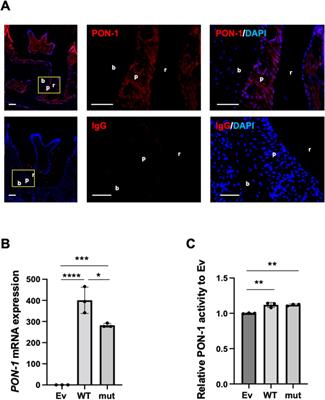 Single nucleotide polymorphism rs854560 in paraoxonase-1 regulates the cytodifferentiation of human periodontal ligament cells